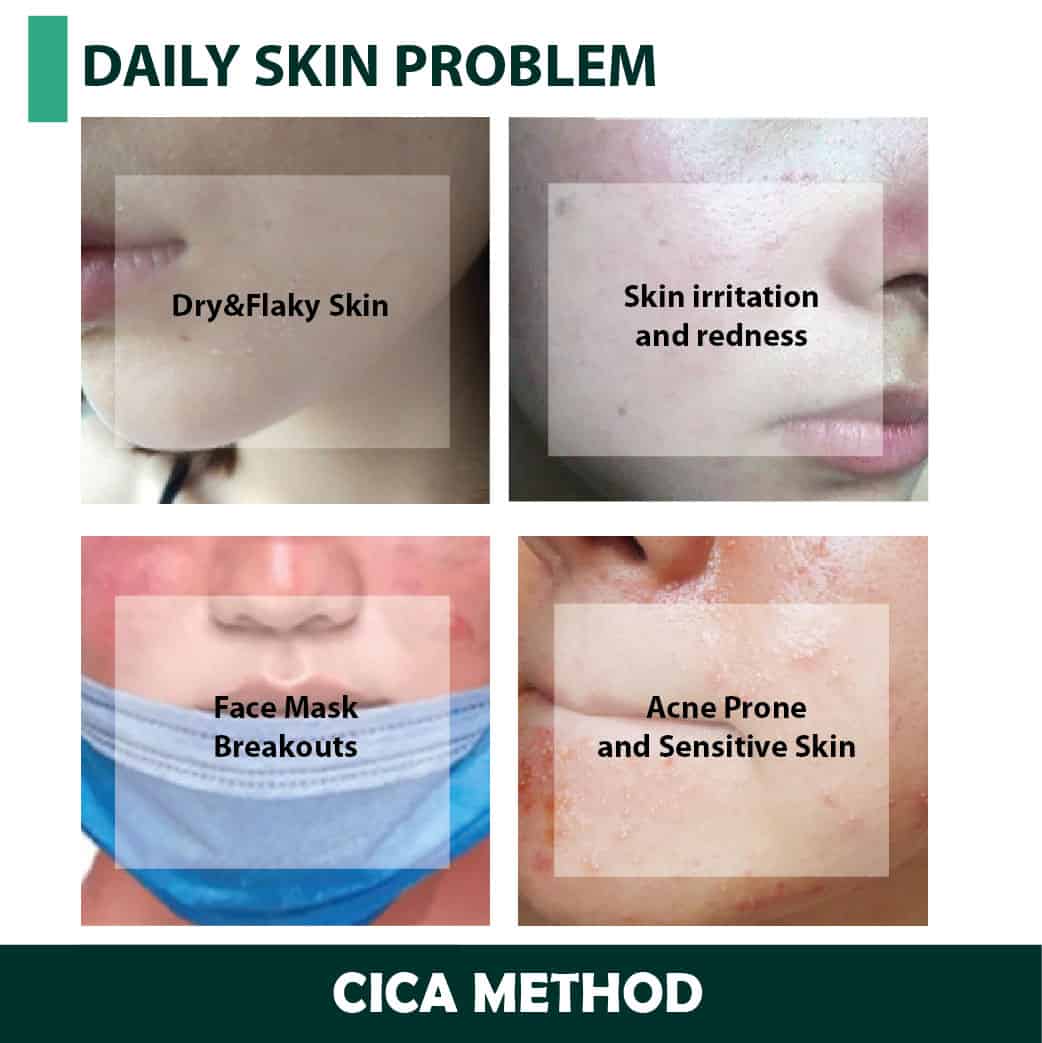 CICA method CREAM 50g — additional photo